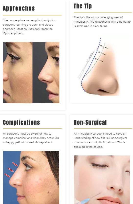 London Rhinoplasty Course PLASTA